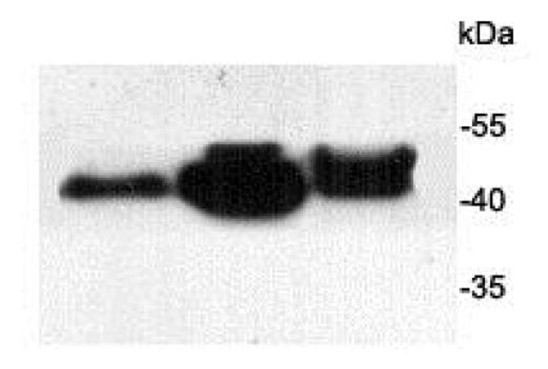 Western blot analysis of NIH/3T3(Lane 1) human heart(Lane 2) Mouse heart(Lane 3) using Alpha-Actin (Smooth Muscle) antibody