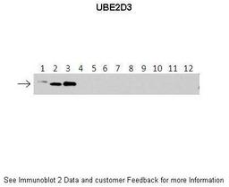 Antibody used in WB on recombinant protein at: 1:500 (Lanes: 1: 40ng HIS-UBE2D1 protein, 2: 40ng HIS-UBE2D2 protein, 3: 40ng HIS-UBE2D3 proteinm, 4: 40ng HIS-UBE2D4 protein, 5: 40ng HIS-UBE2E1 protein, 6: 40ng HIS-UBE2E2 protein, 7: 40ng HIS-UBE2E3 protei