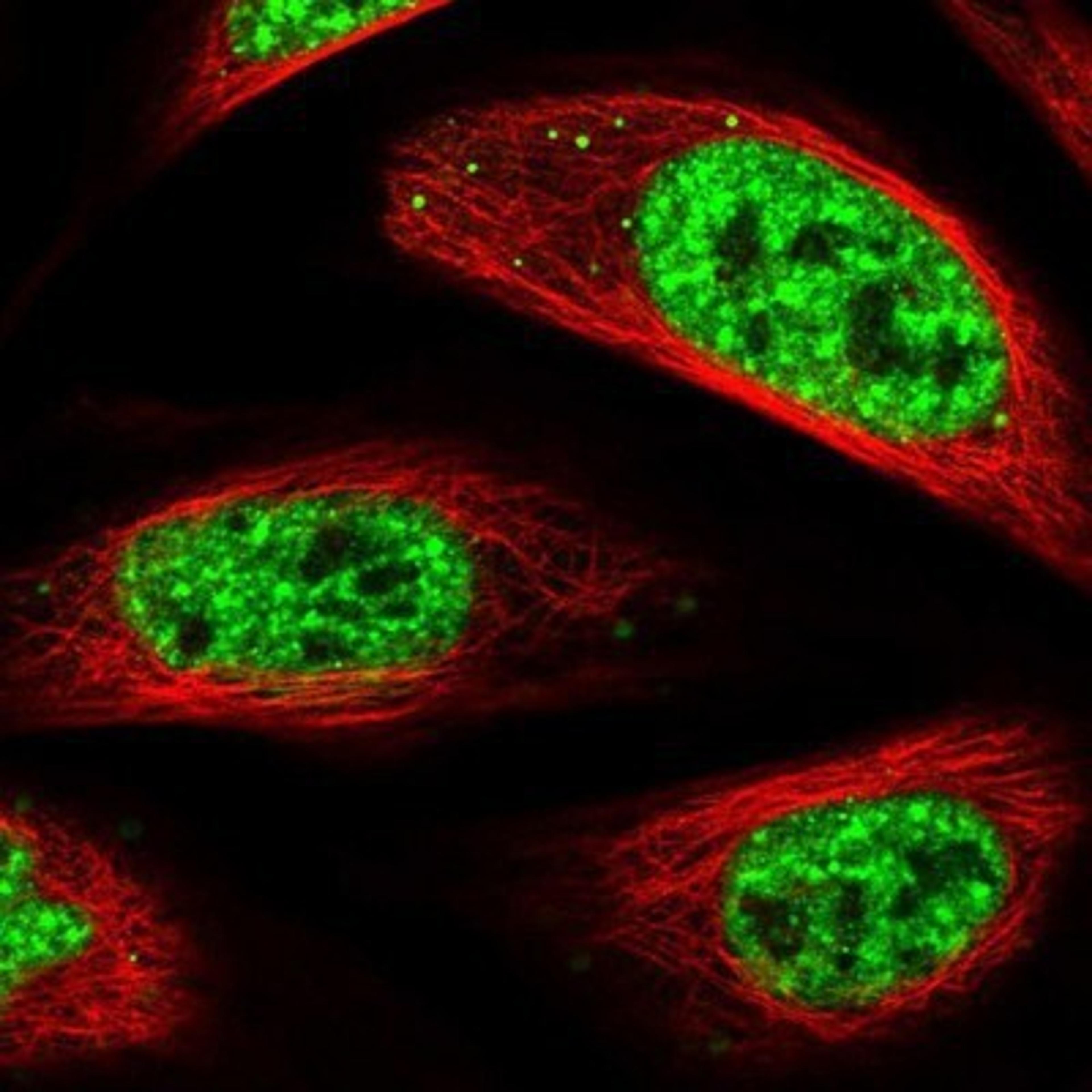 Immunocytochemistry/Immunofluorescence: CHTOP Antibody [NBP1-88085] - Staining of human cell line U-2 OS shows positivity in nucleus but not nucleoli & vesicles.