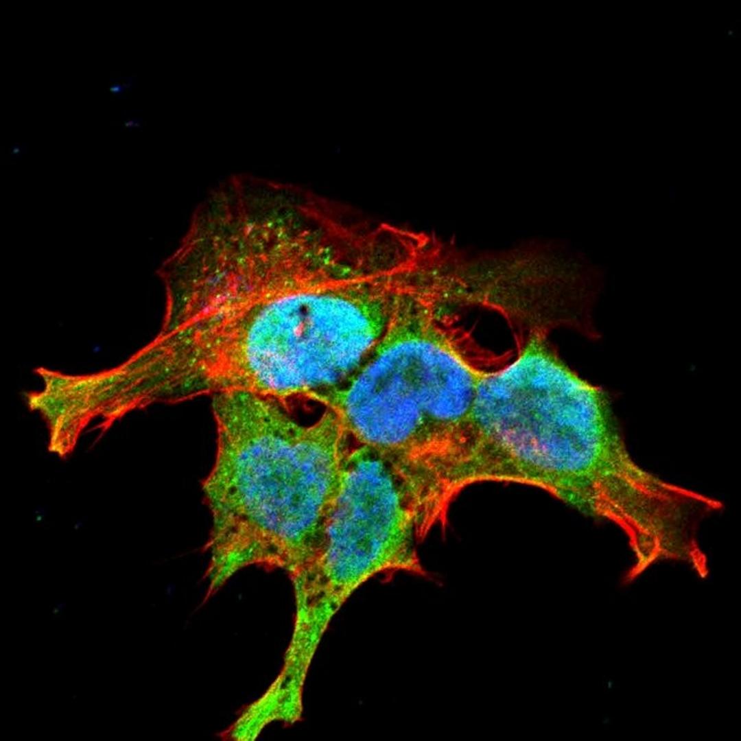 Immunofluorescence analysis of neuroblastoma cell line sk-n-be using GRK antibody