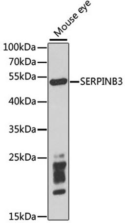 Western blot - SERPINB3 antibody (A5418)