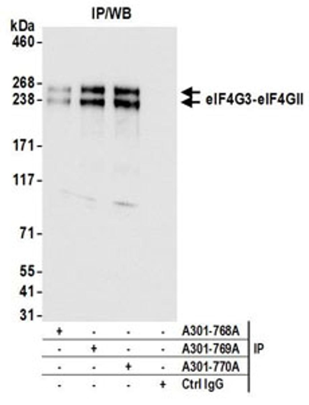 Detection of human eIF4G3/eIF4GII by western blot of immunoprecipitates.