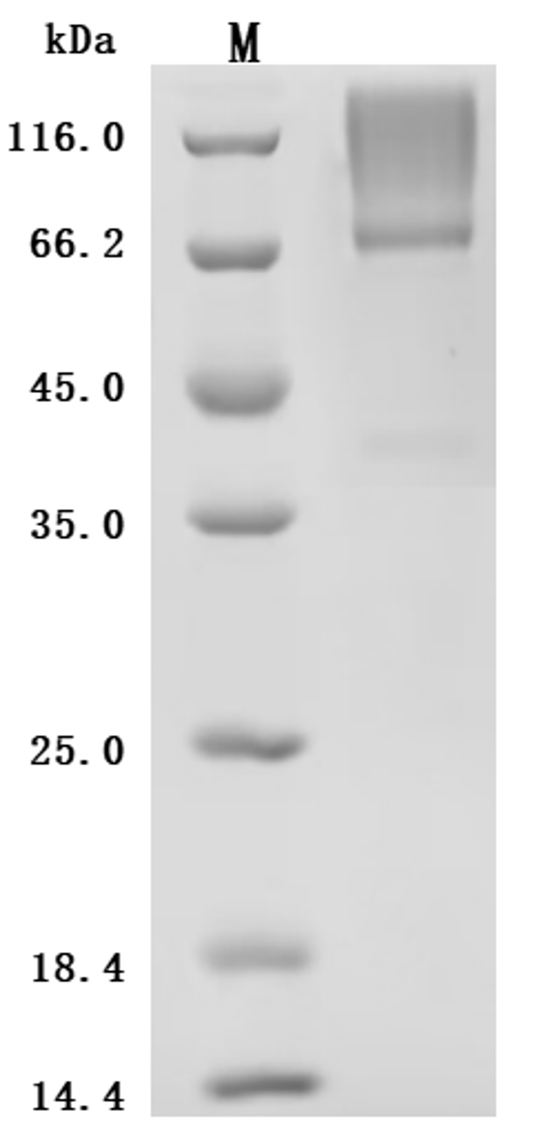 (Tris-Glycine gel) Discontinuous SDS-PAGE (reduced) with 5% enrichment gel and 15% separation gel.