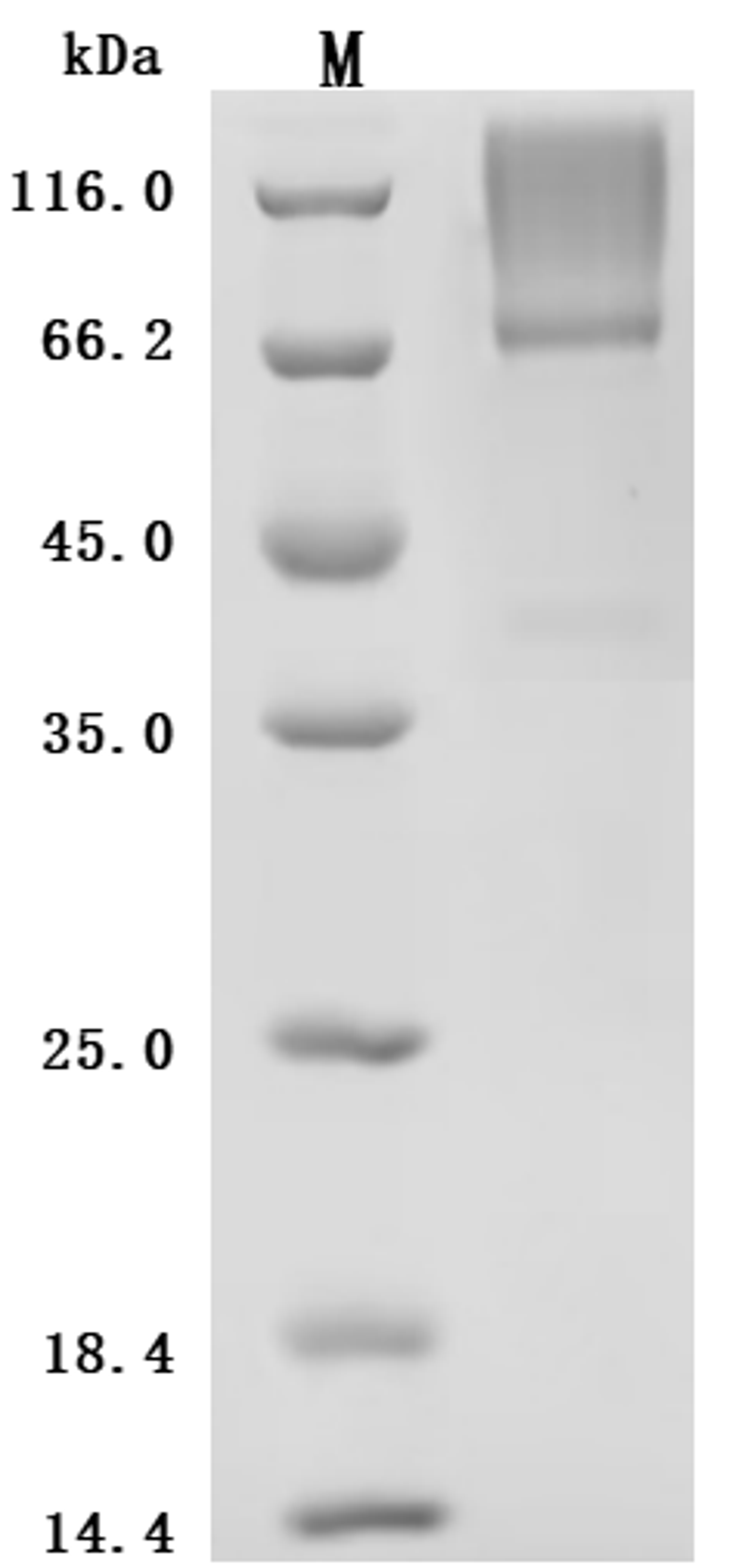 (Tris-Glycine gel) Discontinuous SDS-PAGE (reduced) with 5% enrichment gel and 15% separation gel.