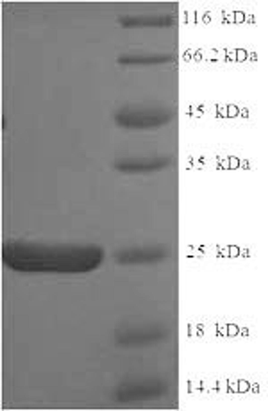 (Tris-Glycine gel) Discontinuous SDS-PAGE (reduced) with 5% enrichment gel and 15% separation gel.