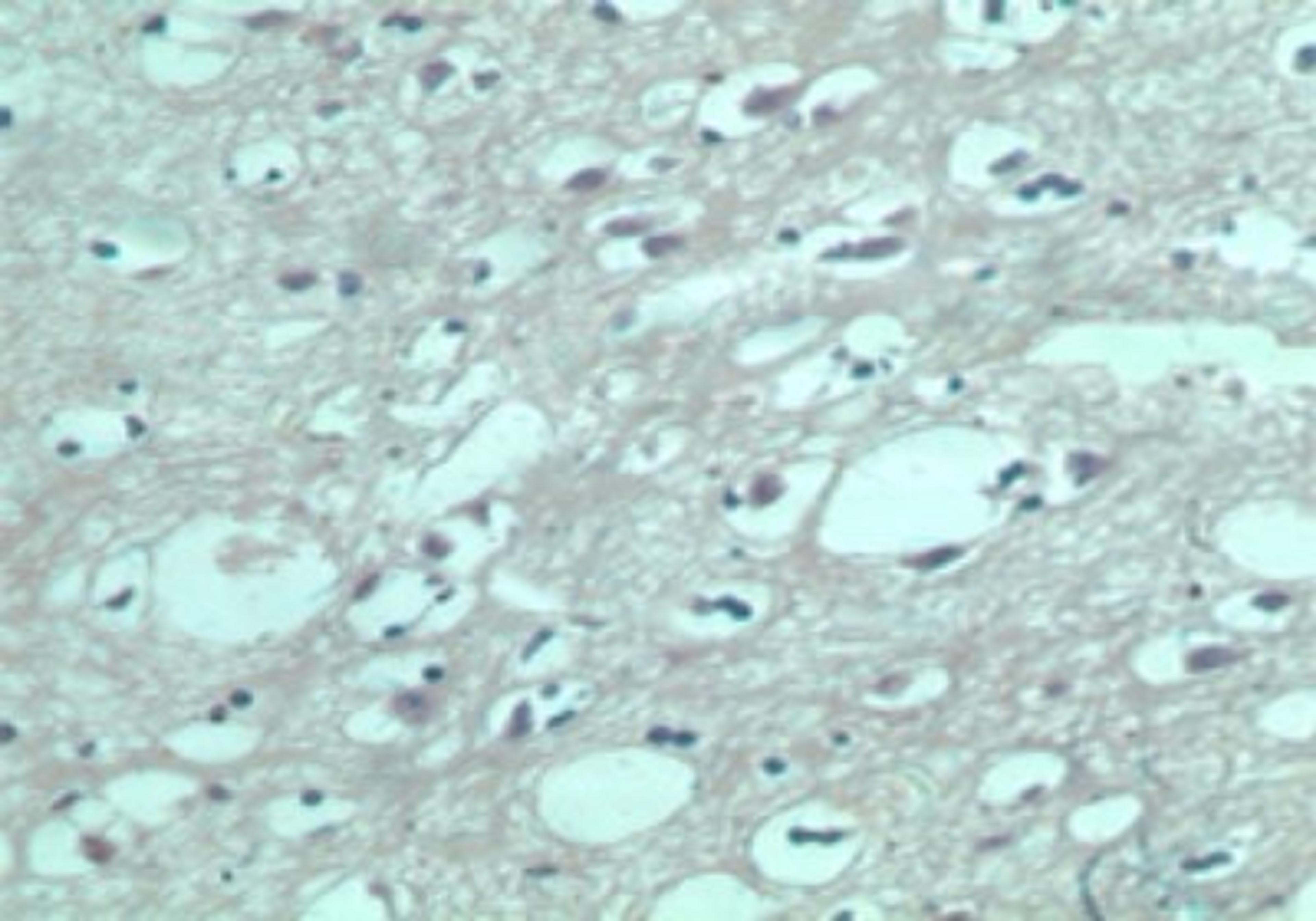 Immunohistochemistry-Paraffin: EDG8 Antibody [NBP2-24712] - IHC (paraffin) staining of normal human brain using control (rabbit Ig) at 5 ug/ml.