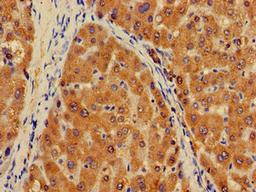 Immunohistochemistry of paraffin-embedded human liver tissue using CSB-PA659725LA01HU at dilution of 1:100