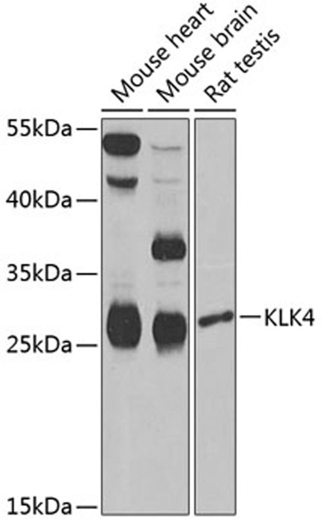 Western blot - KLK4 Antibody (A6642)