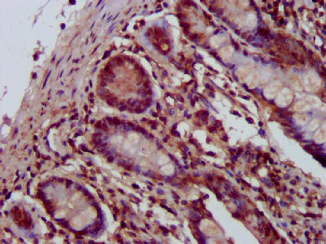 IHC image of CSB-PA619905LA01HU diluted at 1:400 and staining in paraffin-embedded human small intestine tissue performed on a Leica BondTM system. After dewaxing and hydration, antigen retrieval was mediated by high pressure in a citrate buffer (pH 6.0). Section was blocked with 10% normal goat serum 30min at RT. Then primary antibody (1% BSA) was incubated at 4°C overnight. The primary is detected by a biotinylated secondary antibody and visualized using an HRP conjugated SP system.