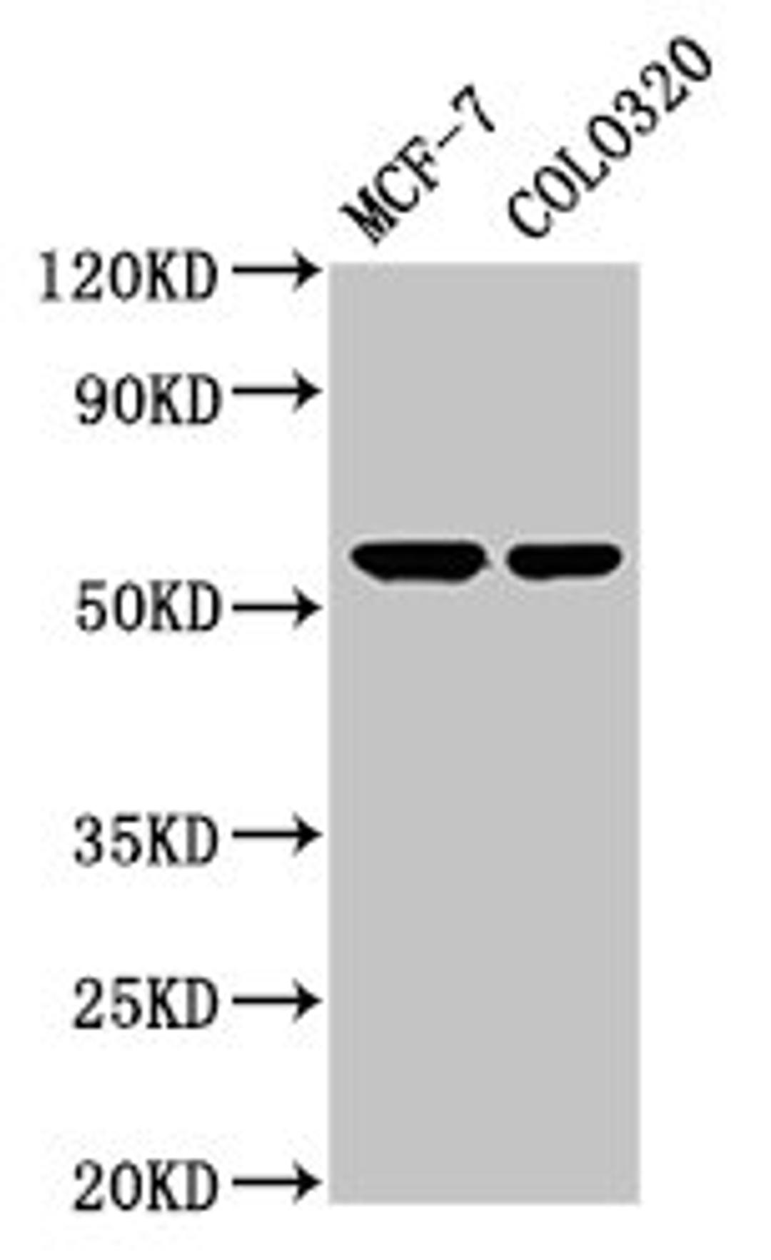 Western Blot. Positive WB detected in: MCF-7 whole cell lysate, Colo320 whole cell lysate. All lanes: MYOC antibody at 5.2µg/ml. Secondary. Goat polyclonal to rabbit IgG at 1/50000 dilution. Predicted band size: 57 kDa. Observed band size: 57 kDa