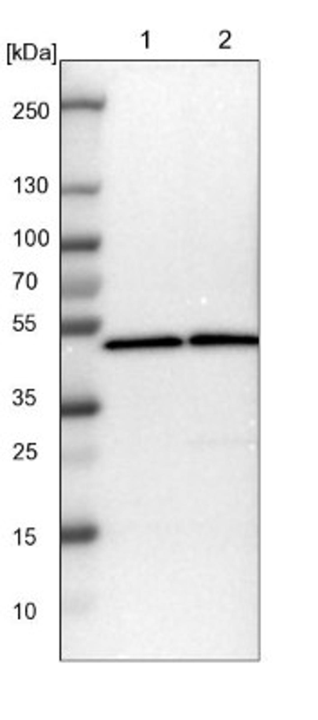 Western Blot: LPAR3/LPA3/EDG-7 Antibody [NBP1-84903] - Lane 1: NIH-3T3 cell lysate (Mouse embryonic fibroblast cells)<br/>Lane 2: NBT-II cell lysate (Rat Wistar bladder tumour cells)