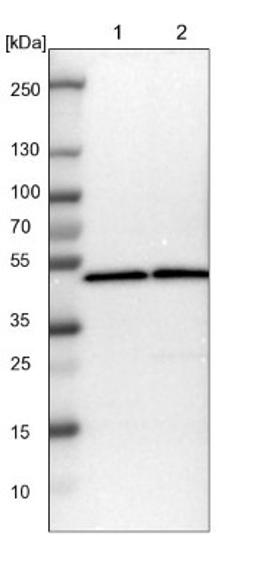 Western Blot: LPAR3/LPA3/EDG-7 Antibody [NBP1-84903] - Lane 1: NIH-3T3 cell lysate (Mouse embryonic fibroblast cells)<br/>Lane 2: NBT-II cell lysate (Rat Wistar bladder tumour cells)