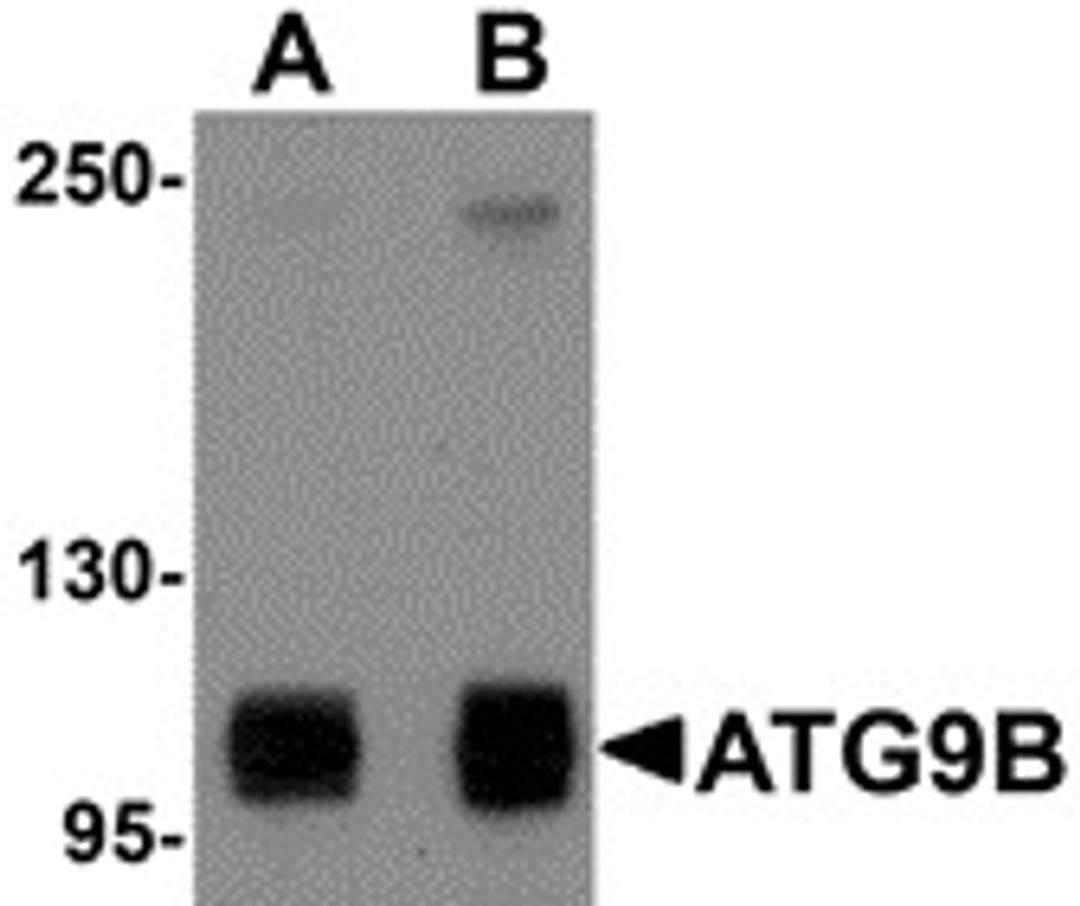 Western blot analysis of HeLa cell lysate probed with Rabbit anti Human ATG9B