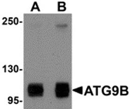 Western blot analysis of HeLa cell lysate probed with Rabbit anti Human ATG9B