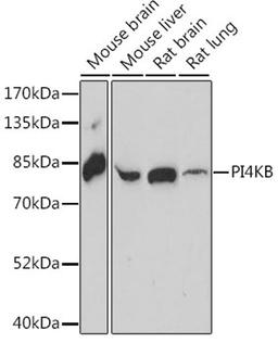 Western blot - PI4KB antibody (A16416)