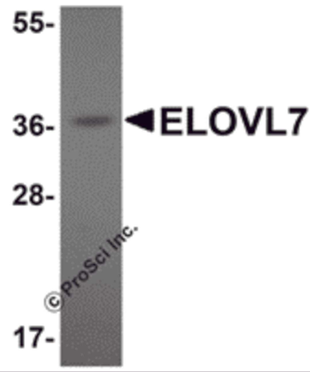 Western blot analysis of ELOVL7 in human liver tissue lysate with ELOVL7 antibody at 1 μg/mL.