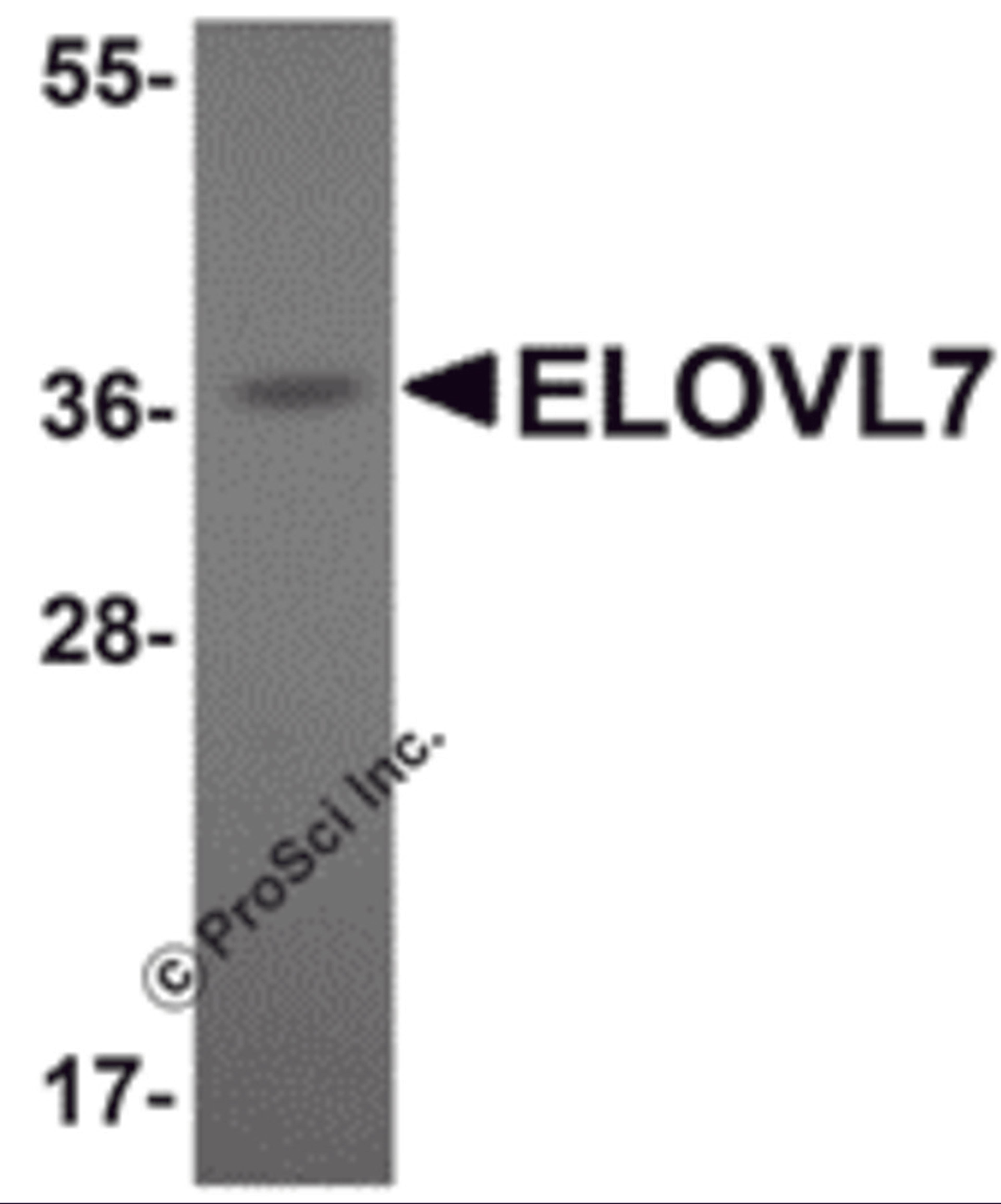Western blot analysis of ELOVL7 in human liver tissue lysate with ELOVL7 antibody at 1 μg/mL.