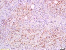 Immunohistochemical staining of mouse lymph tissueoma tissue using CD5l antibody.