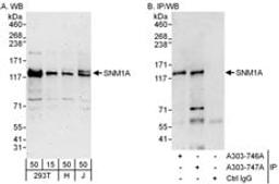 Detection of human SNM1A by western blot and immunoprecipitation.