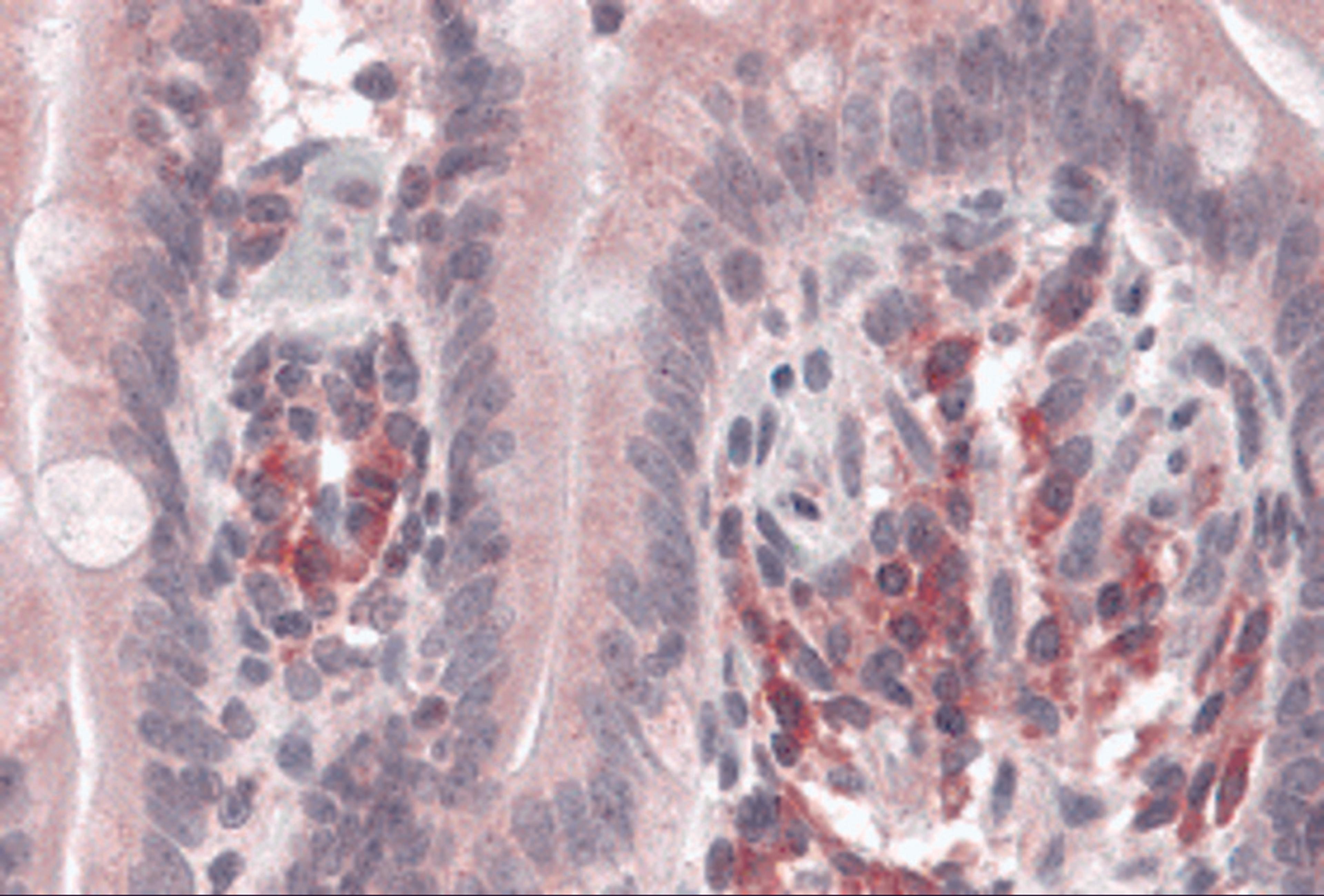 Immunohistochemistry of VARP in human small intestine with VARP antibody at 5 μg/mL.