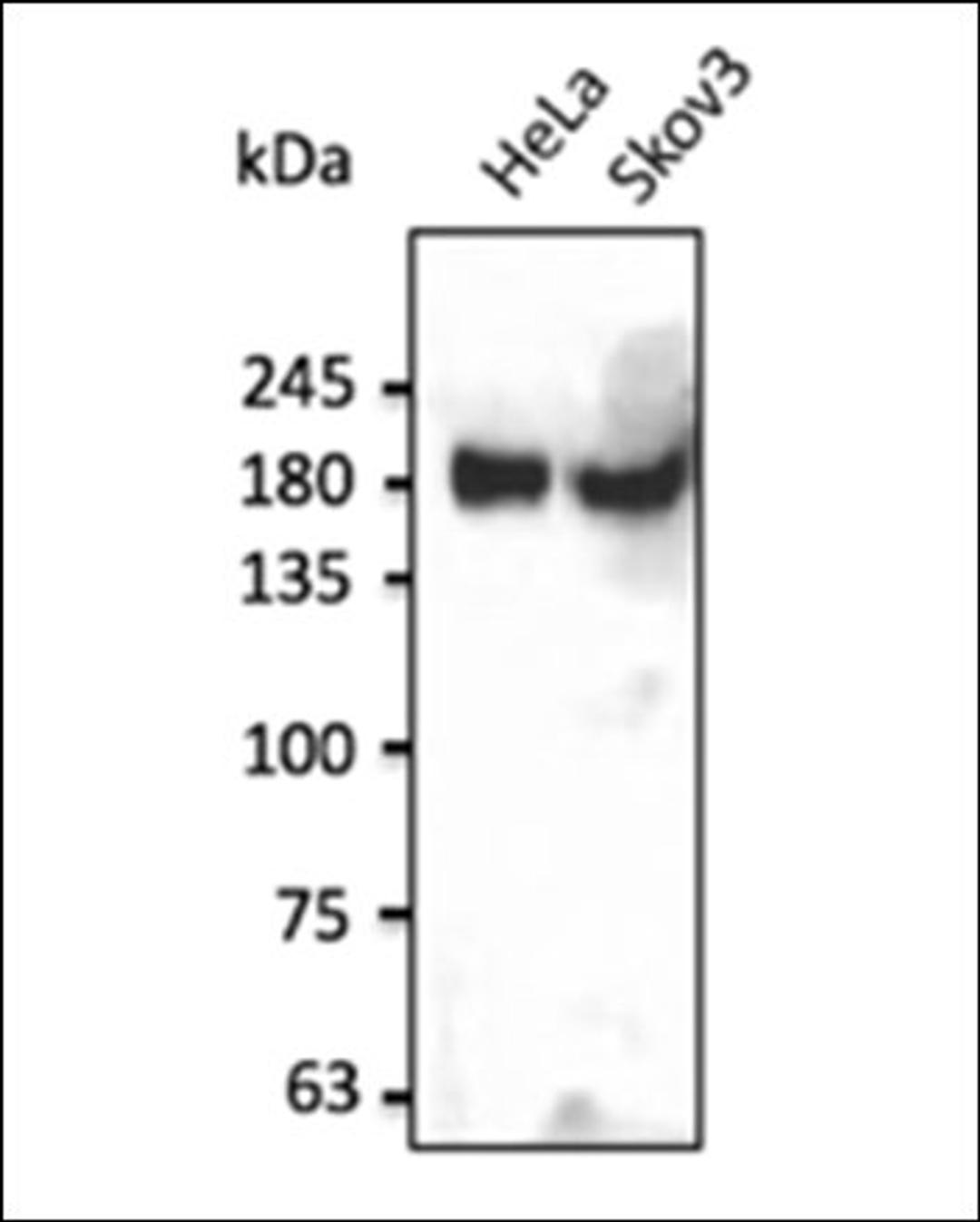 Western blot analysis of human recombinant protein using INSR antibody