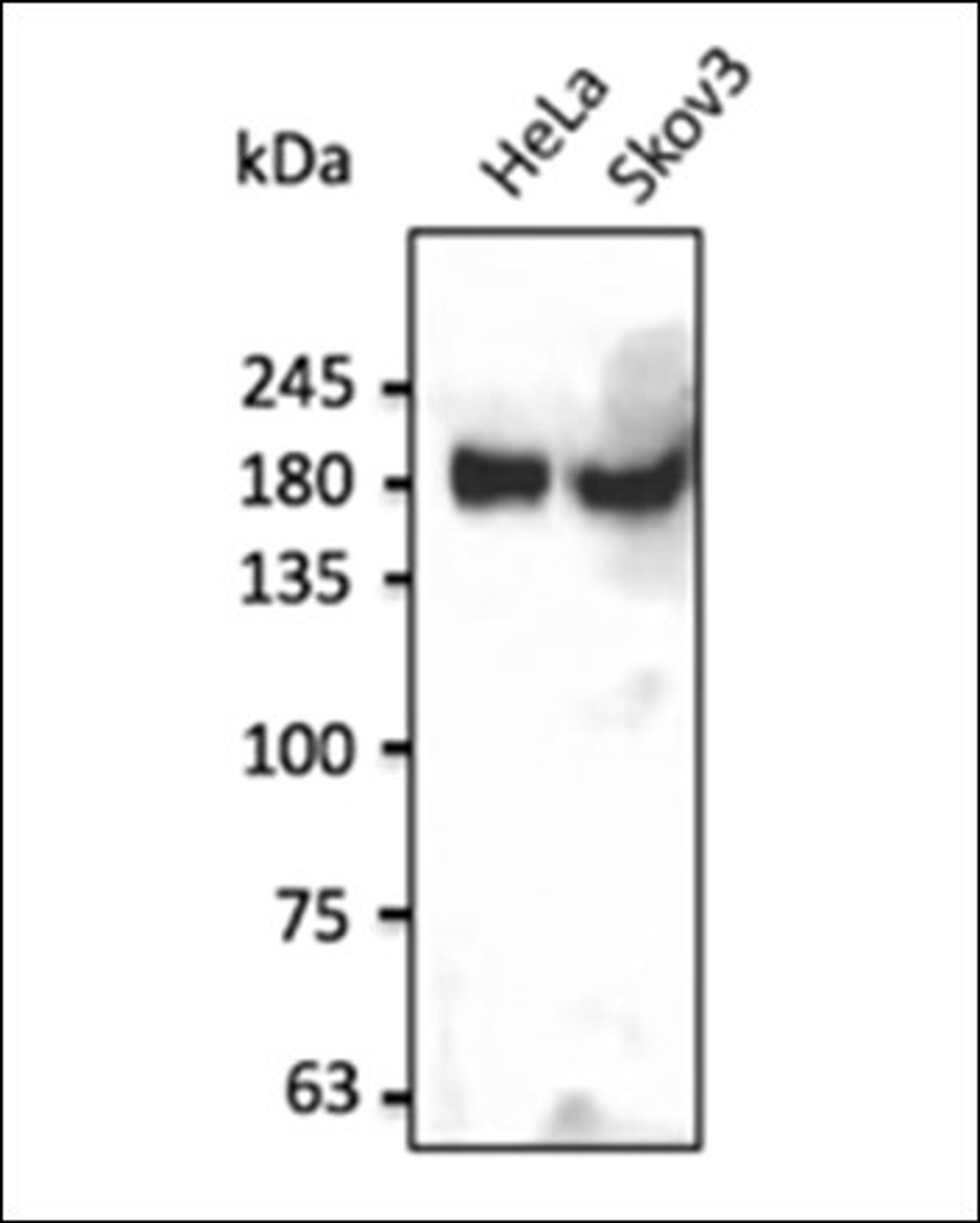 Western blot analysis of human recombinant protein using INSR antibody