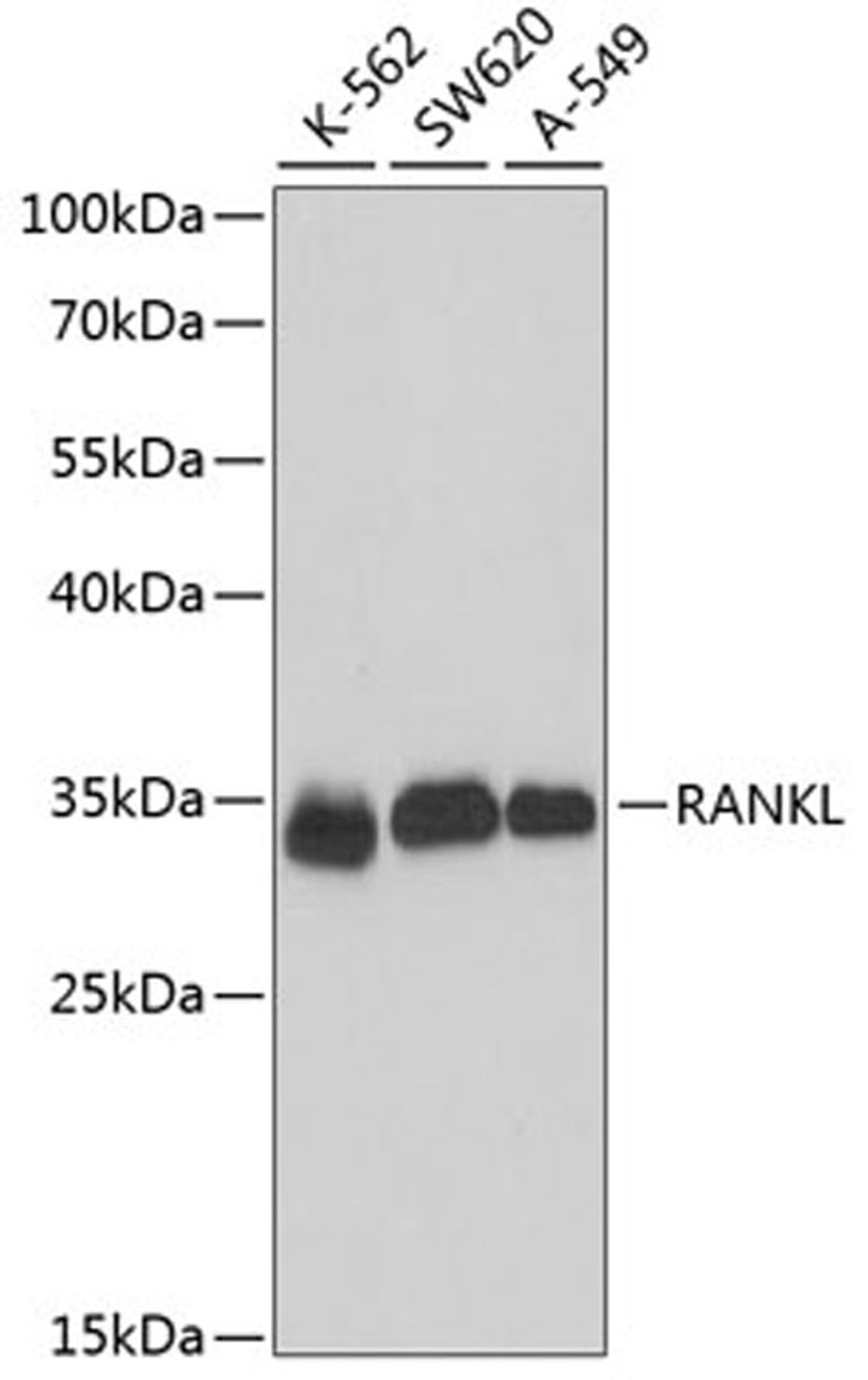 Western blot - RANKL antibody (A16326)