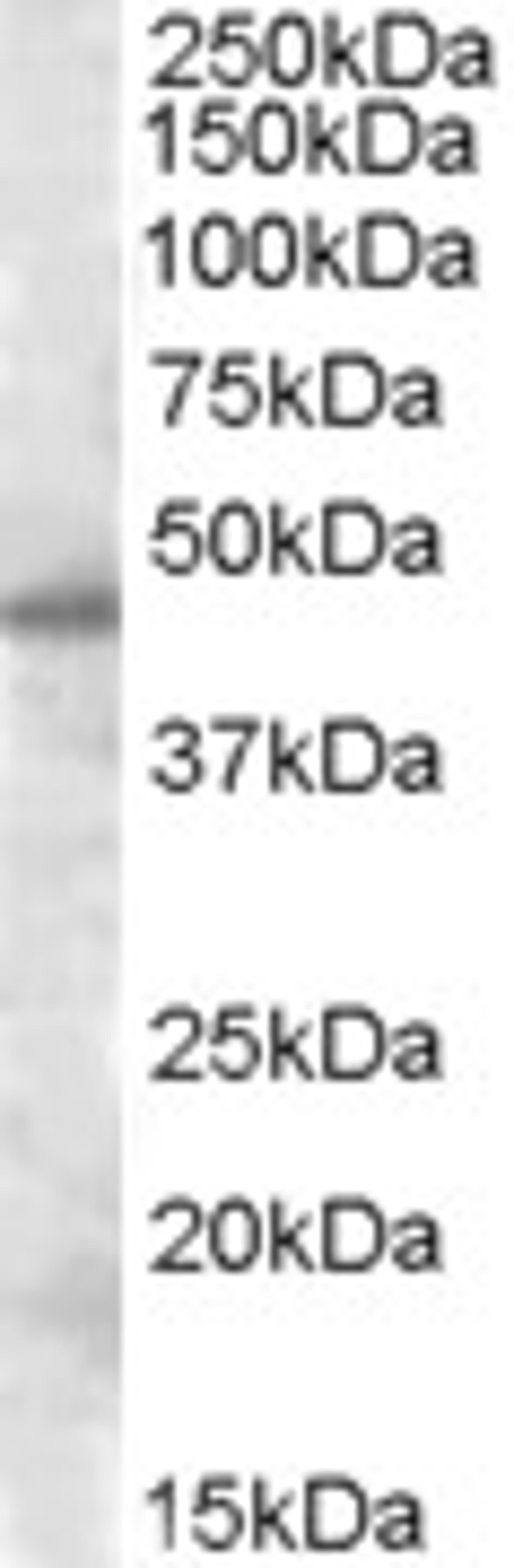 46-757 (0.5ug/ml) staining of nuclear HeLa lysate (35ug protein in RIPA buffer). Primary incubation was 1 hour. Detected by chemiluminescence.