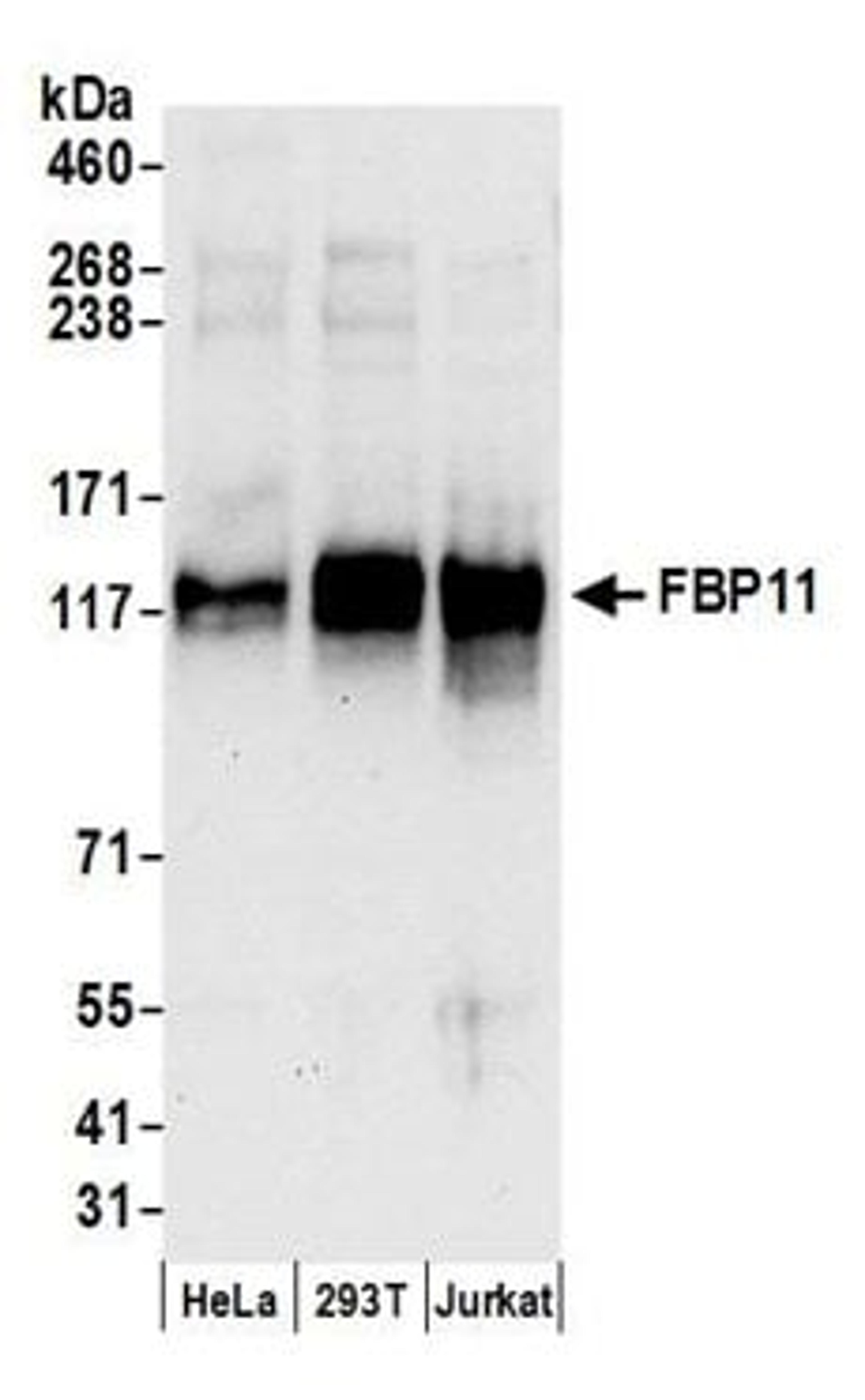 Detection of human FBP11 by western blot.