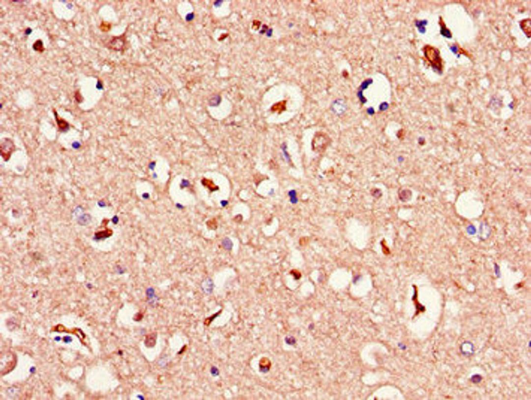 Immunohistochemistry of paraffin-embedded human brain tissue using CSB-PA013449LA01HU at dilution of 1:100