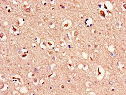 Immunohistochemistry of paraffin-embedded human brain tissue using CSB-PA013449LA01HU at dilution of 1:100