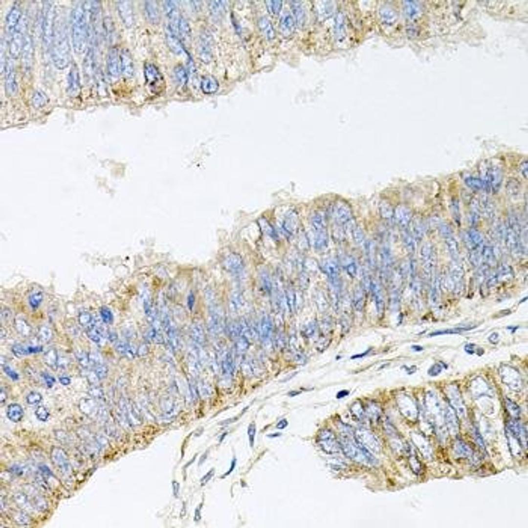 Immunohistochemical staining of mouse lung tissue using GP2 antibody (dilution of 1:100)