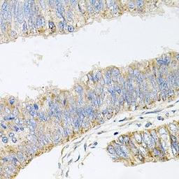 Immunohistochemical staining of mouse lung tissue using GP2 antibody (dilution of 1:100)