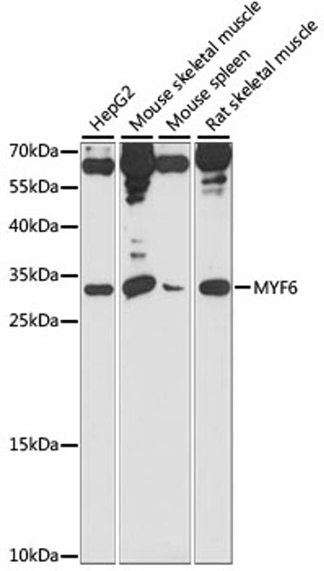 Western blot - MYF6 antibody (A15291)