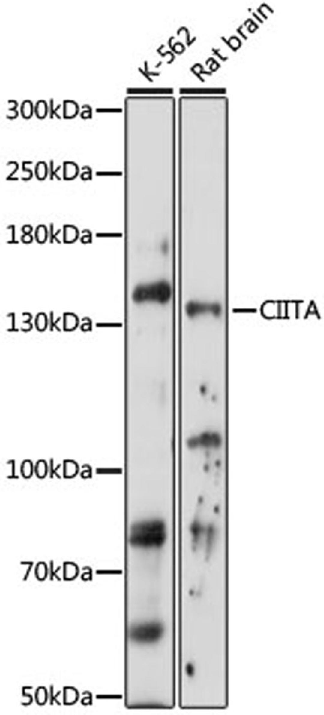 Western blot - CIITA antibody (A16401)