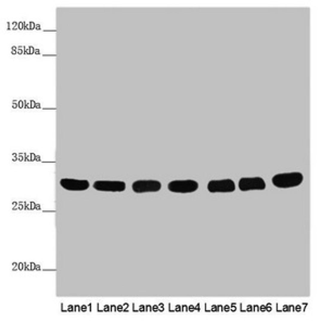 Western blot. All lanes: MTX2 antibody at 3.79 ug/ml. Lane 1: Mouse heart tissue. Lane 2: Mouse kidney tissue. Lane 3: Mouse liver tissue. Lane 4: Jurkat whole cell lysate. Lane 5: MCF-7 whole cell lysate. Lane 6: HepG2 whole cell lysate. Lane 7: 293T whole cell lysate. Secondary. Goat polyclonal to rabbit IgG at 1/10000 dilution. Predicted band size: 30, 29 kDa. Observed band size: 30 kDa. 