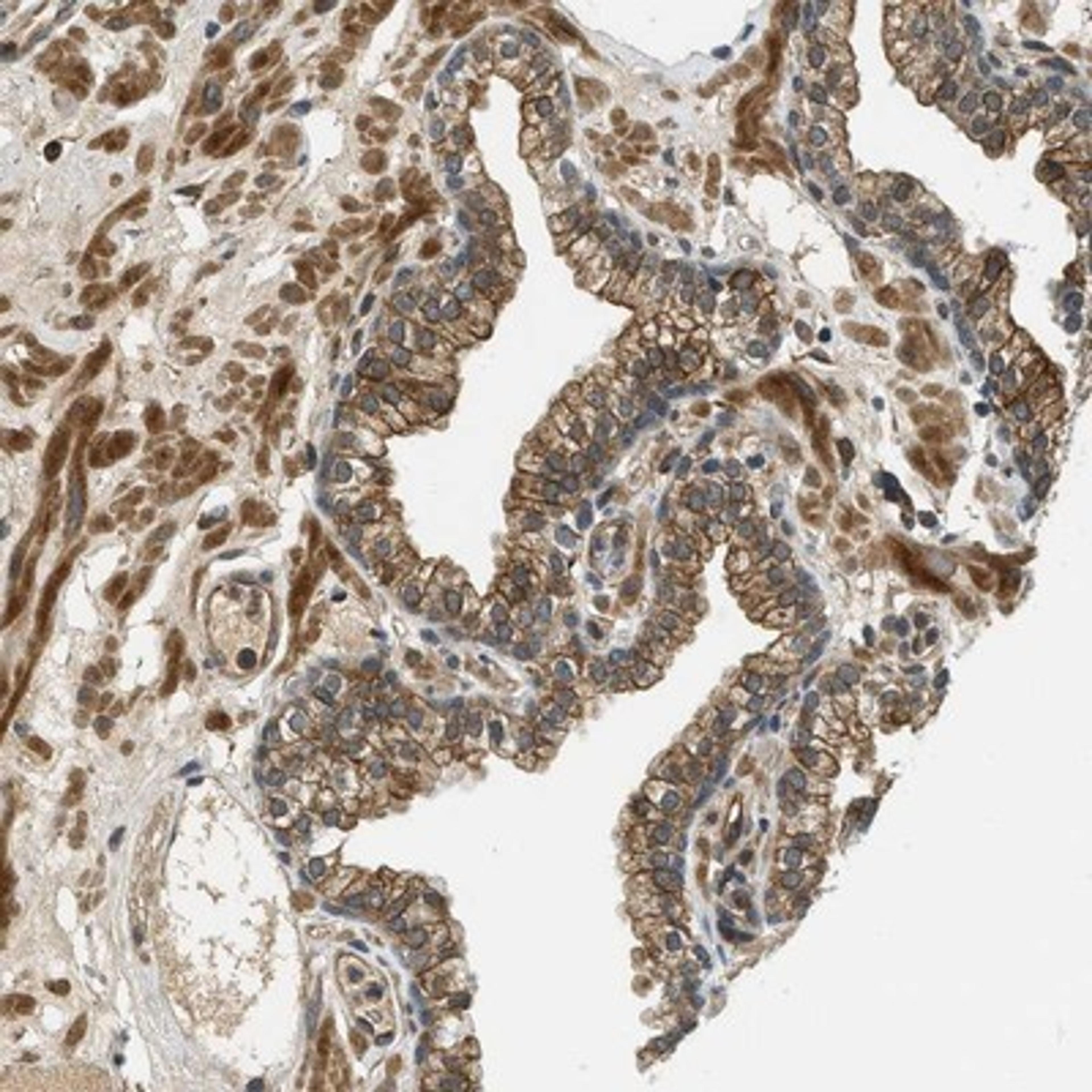 Immunohistochemistry-Paraffin: CHST8 Antibody [NBP1-83396] - Staining of human prostate shows membranous and cytoplasmic positivity in glandular cells.