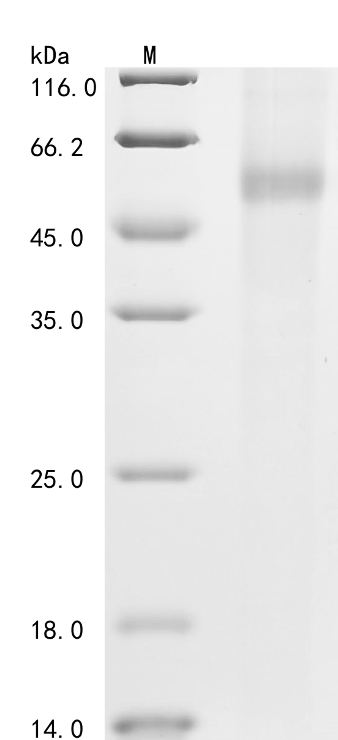 (Tris-Glycine gel) Discontinuous SDS-PAGE (reduced) with 5% enrichment gel and 15% separation gel.