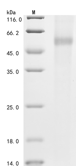 (Tris-Glycine gel) Discontinuous SDS-PAGE (reduced) with 5% enrichment gel and 15% separation gel.
