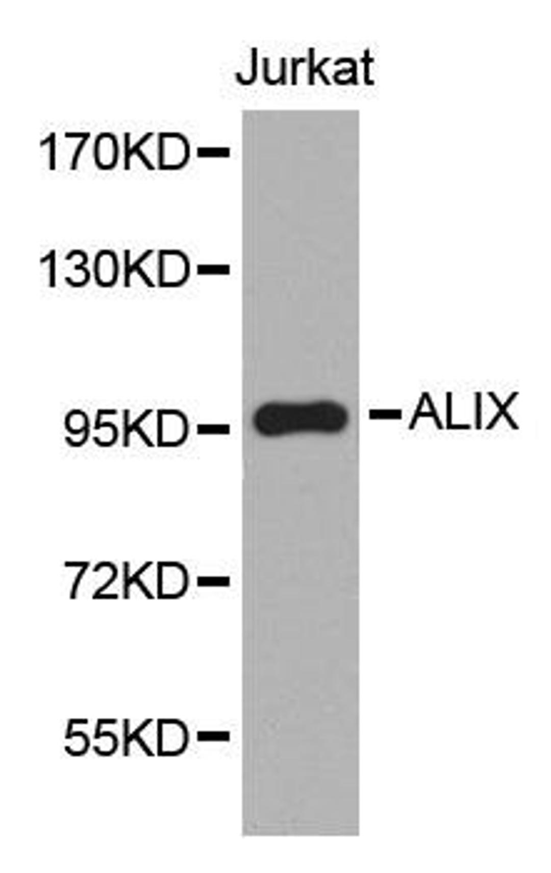 Western blot analysis of extracts of Jurkat cell line using ALIX antibody