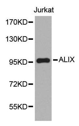 Western blot analysis of extracts of Jurkat cell line using ALIX antibody