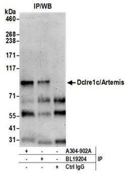 Detection of mouse Dclre1c/Artemis by western blot of immunoprecipitates.