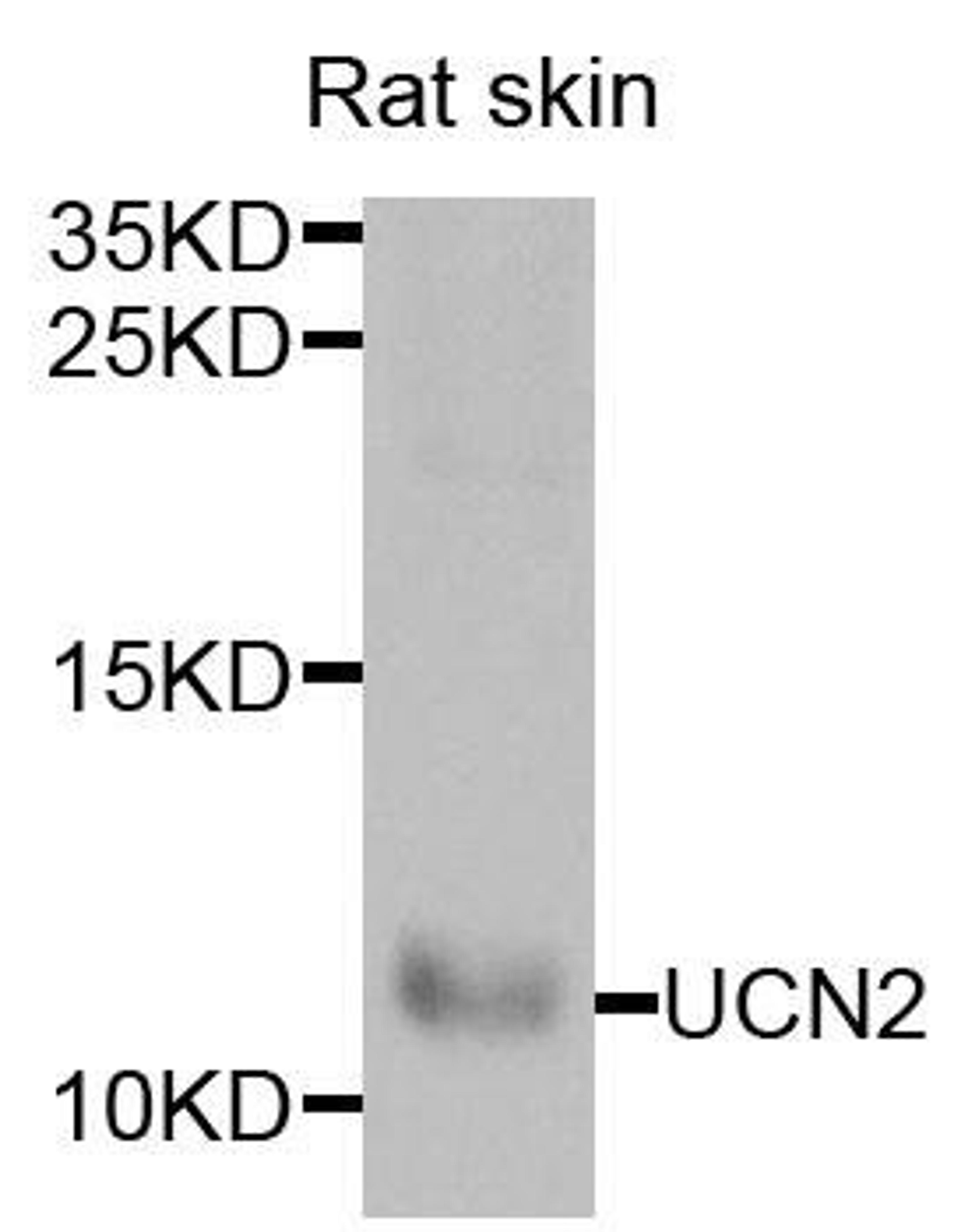 Western blot analysis of extracts of rat skin cells using UCN2 antibody