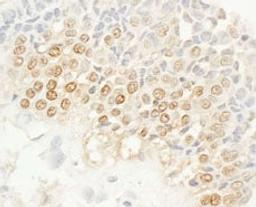 Detection of human NEK4 by immunohistochemistry.