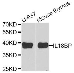 Western blot analysis of extracts of various cell lines using IL18BP antibody