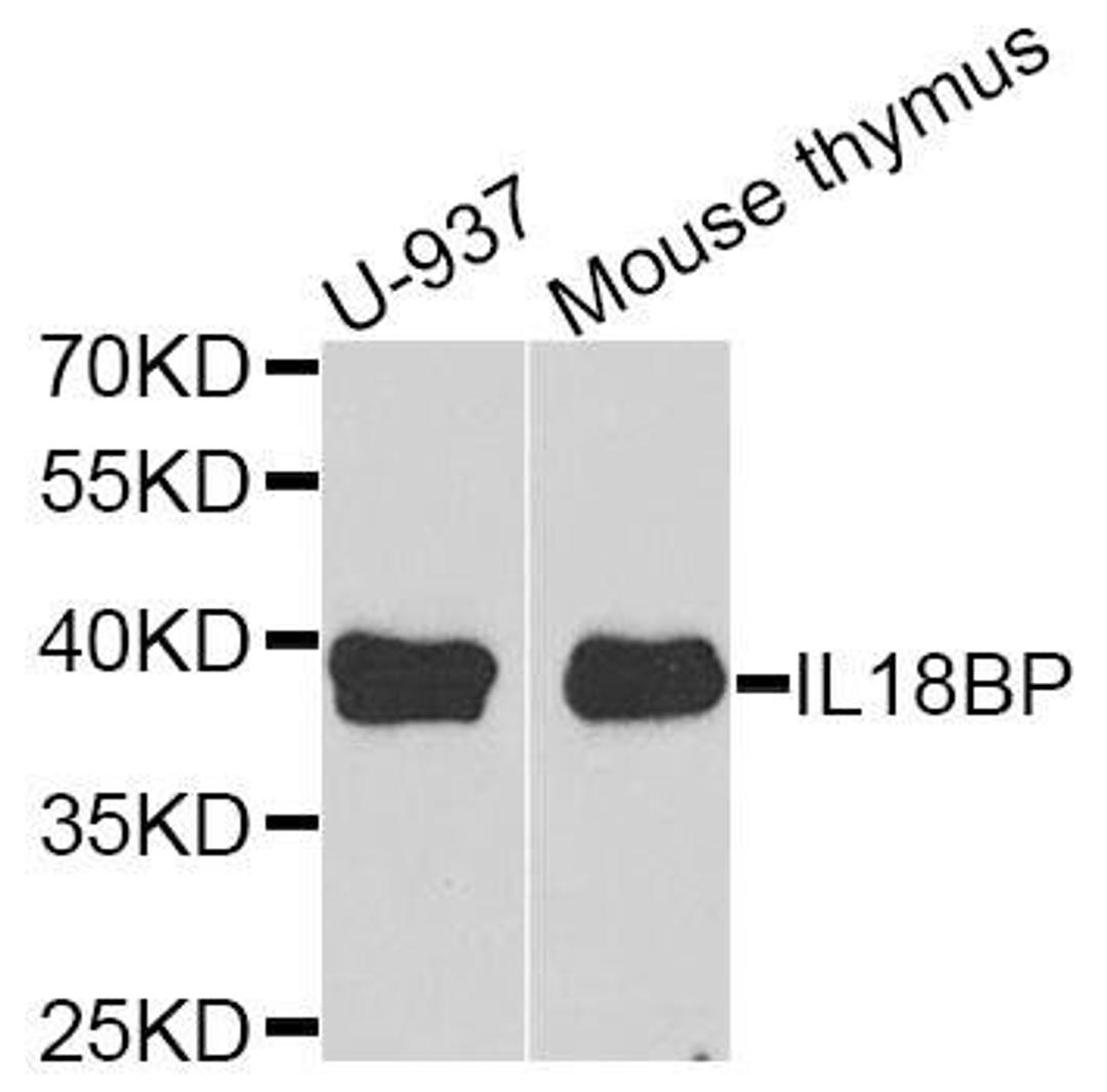 Western blot analysis of extracts of various cell lines using IL18BP antibody