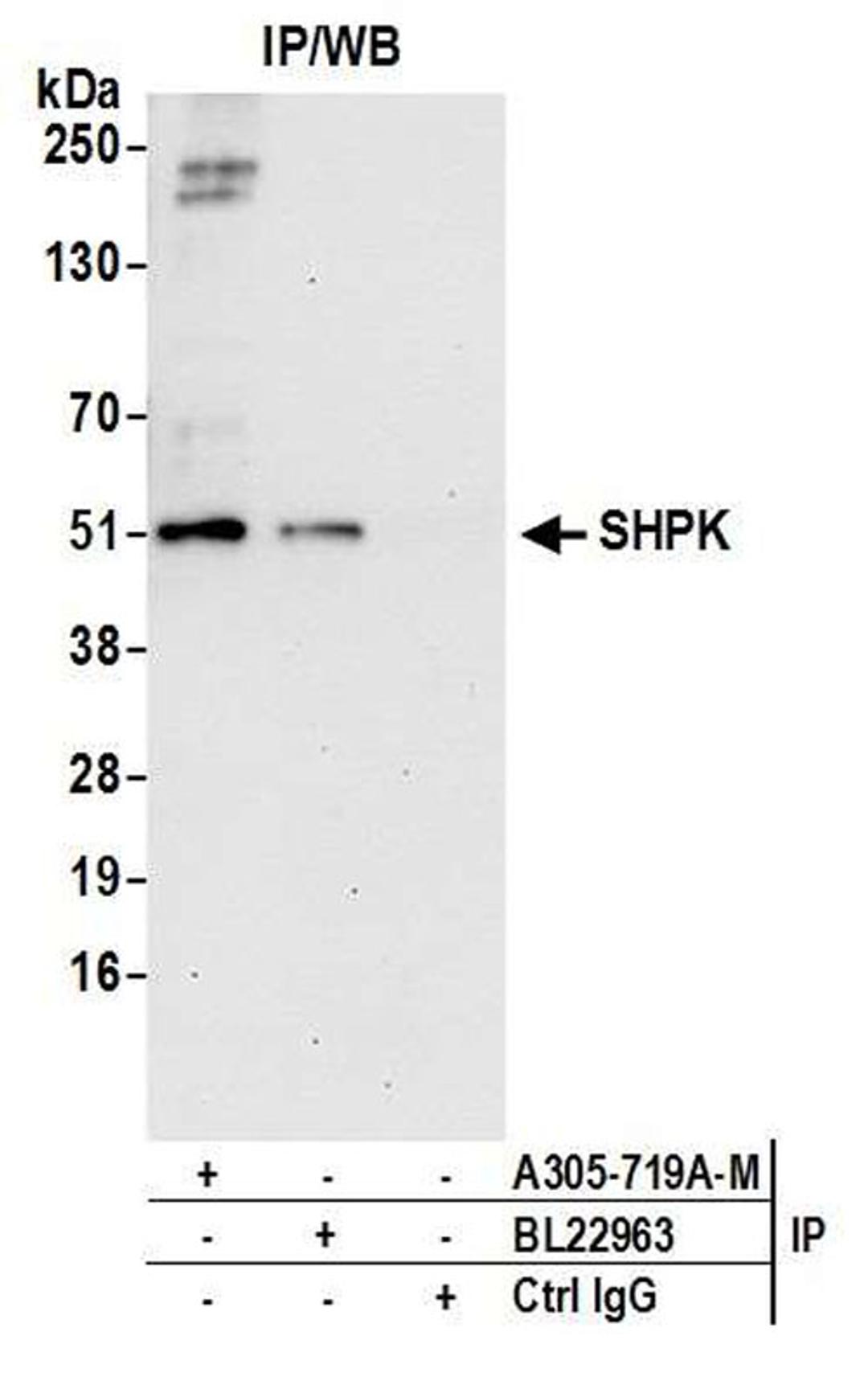 Detection of human SHPK by WB of IP.