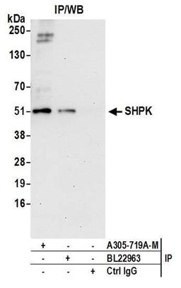 Detection of human SHPK by WB of IP.