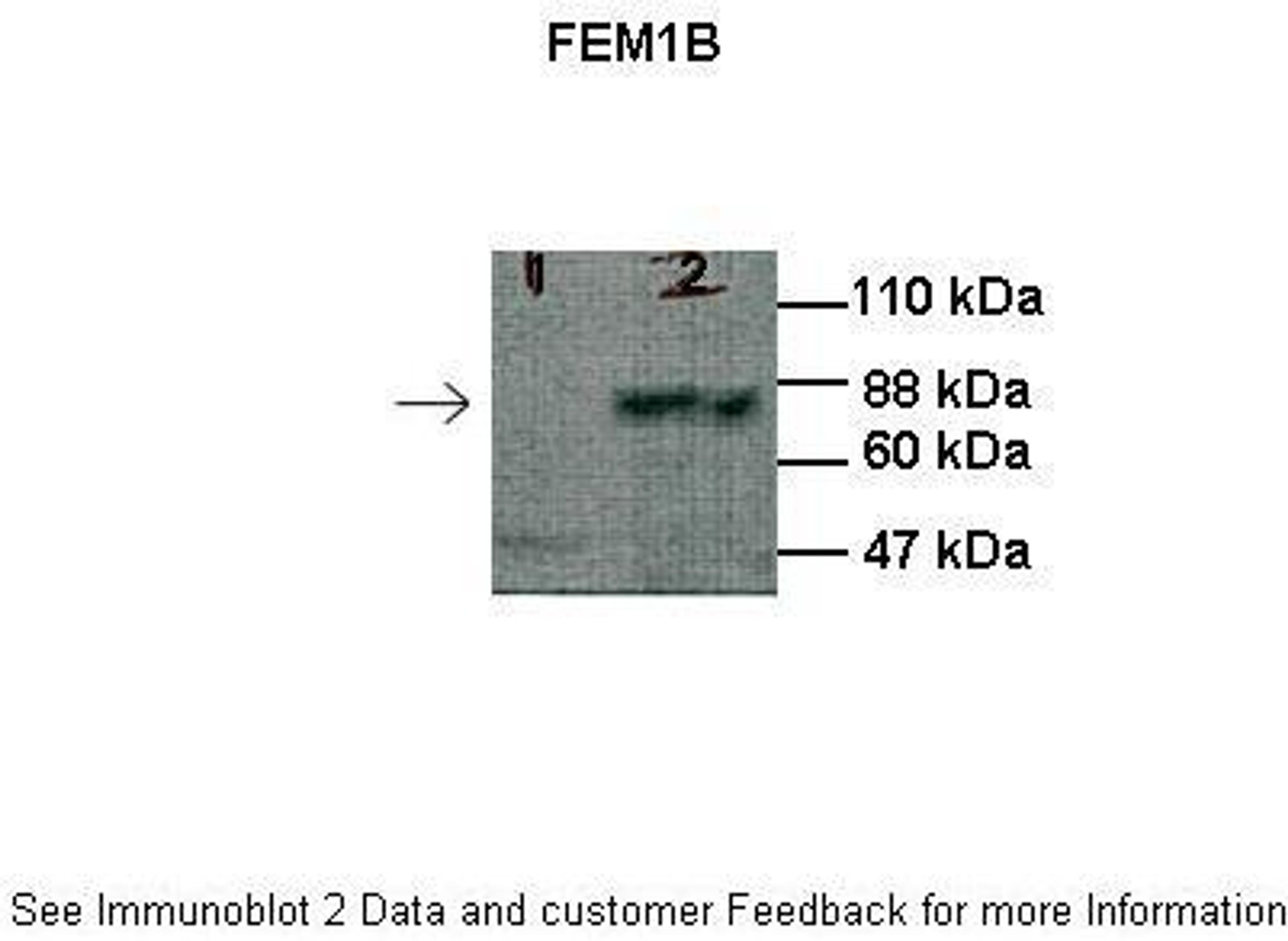 Antibody used in WB on Human HEK293T at: 1:1000 (Lane 1: 30ug HEK293T cell lysate, Lane 2: 30ug 3FLAG-hFEM1B transfected HEK293T cell lysate).