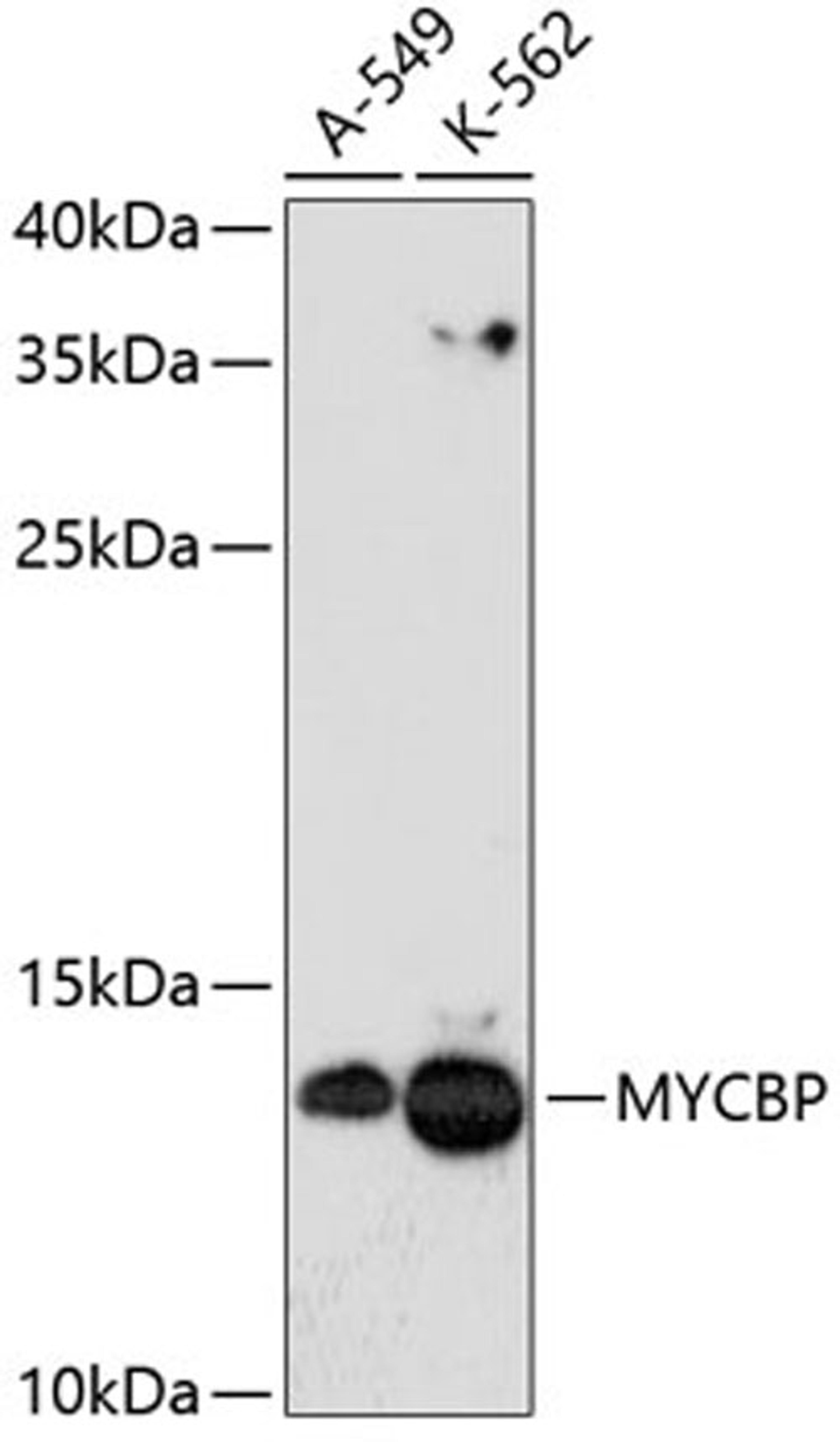 Western blot - MYCBP antibody (A4623)